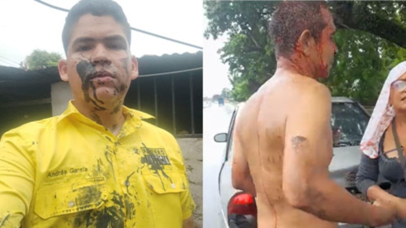 Henrique Capriles dénonce "l'embuscade" de "groupes violents" lors d'un acte à Apure
