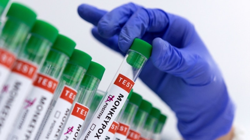 Le Venezuela active la surveillance épidémiologique du Mpox ou du singe