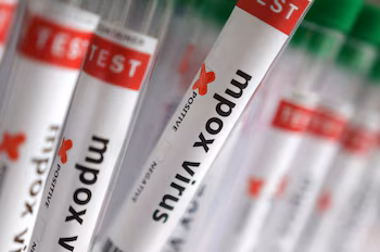 Photo de stock : Illustration de tubes à essai étiquetés "Virus Mpox positif". 20 août 2024. REUTERS/Dado Ruvic/