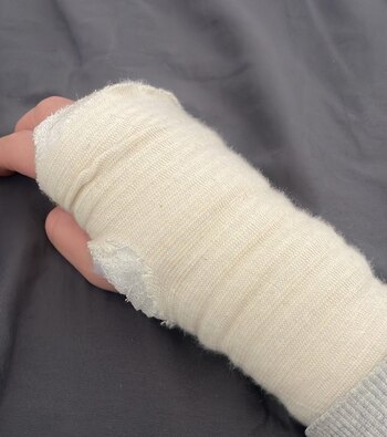 Une serveuse victime d'un accident du travail est licenciée (@SoyCamarero/X)