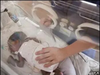 Deux bébés sont décédés en moins de 15 jours après avoir présenté des complications de santé. (PHOTO : BBC)